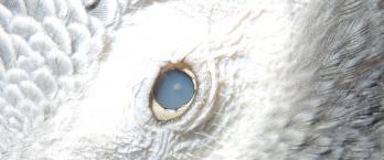 Cataracte gris du gabon